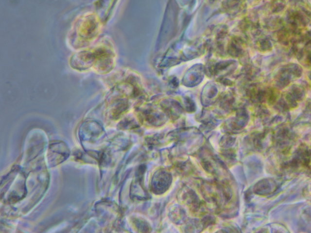 Botryobasidium con spore finemente verrucose